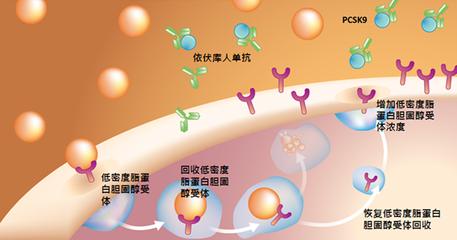 降胆固醇，抗血小板——冠心病的基础治疗
