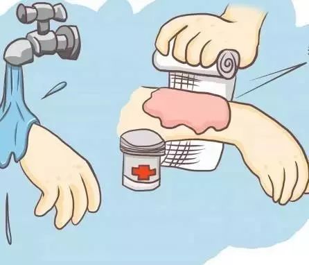 女孩被100度开水烫伤怎么办,女孩掉进汤锅烫伤