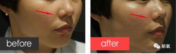 迪丽热巴被p图事件回应,迪丽热巴被p图的视频