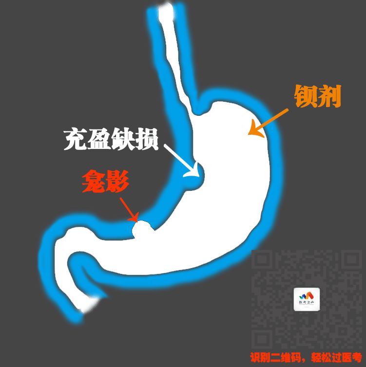 执医技能：X线阅片，全是套路，超简单