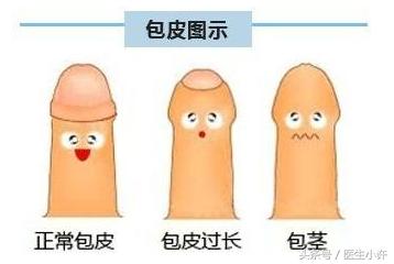 男宝包皮过长什么年龄适合割,包皮过长多大年龄割适合