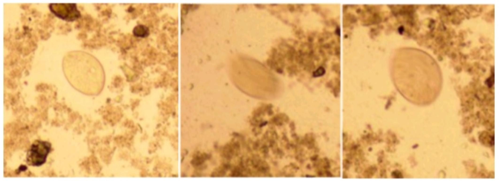 20斤左右的小猪拉稀是什么病,小猪出生几天拉稀死亡是什么原因