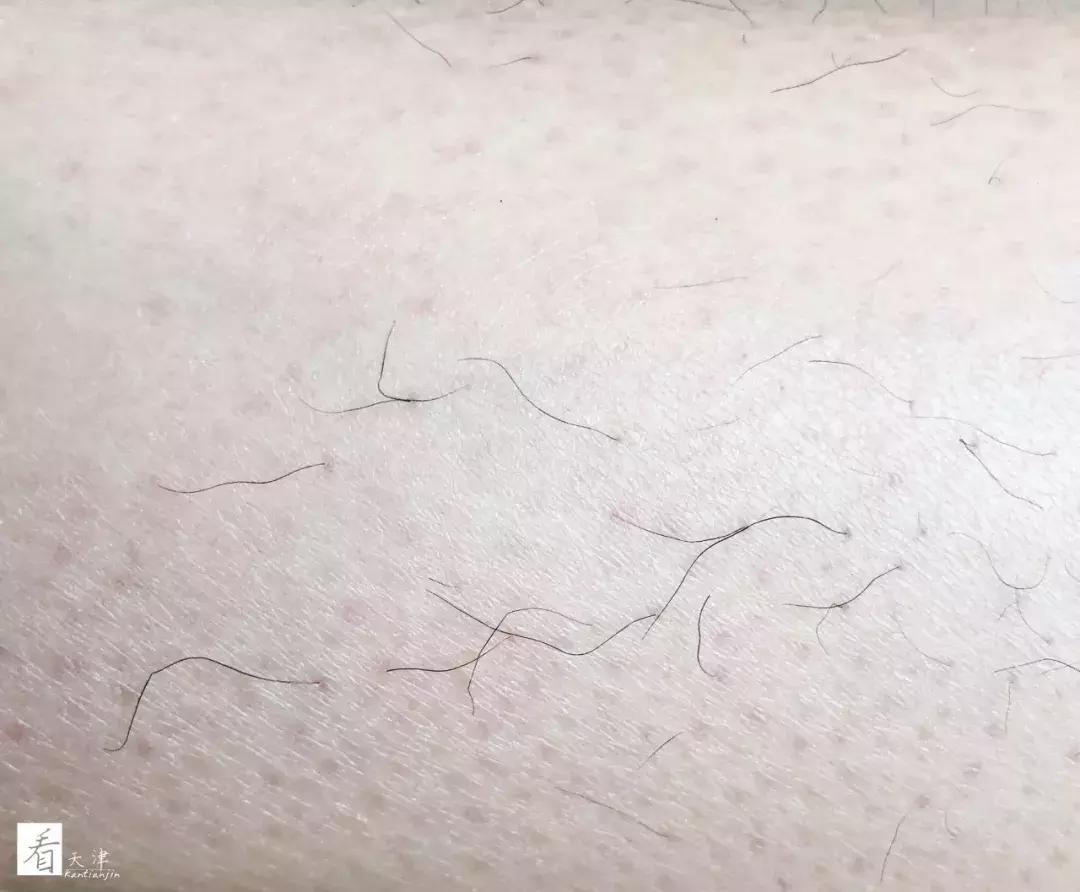 天津小白楼的神店！脱毛后瞬间白2度，原来女神夏天都……