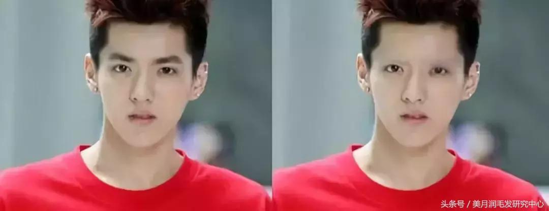 没有眉毛是什么样的,没有眉毛是有多么不方便