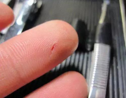 被自行车踏板划伤了要打破伤风吗,破伤风发作进icu一般多久能出来