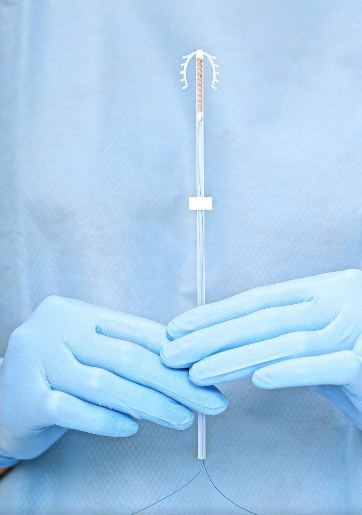 女人上环避孕几率,女性为什么怕避孕环