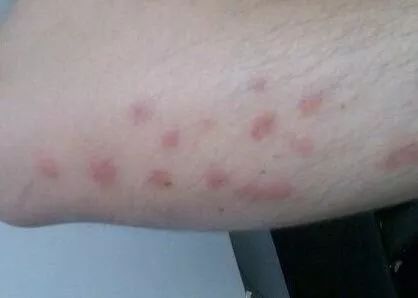 暴雨过后，对于这个烦人的小东西，我们准备了8招~