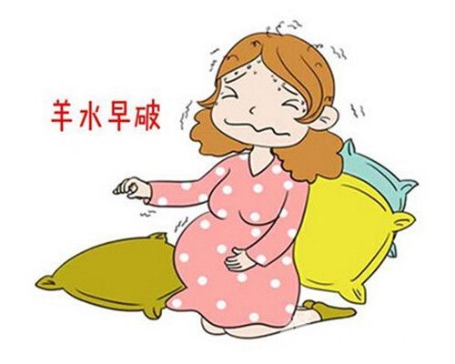临产时破水了内诊要点,孕期发动的前兆是破水还是出血
