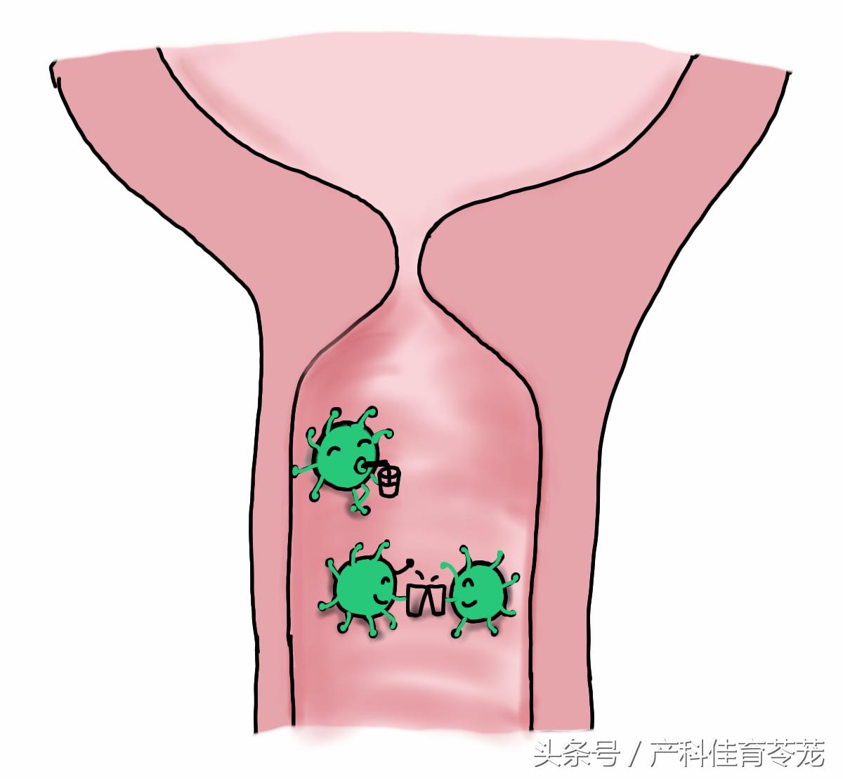 解脲支原体感染如何治疗,肺炎支原体感染治疗方案