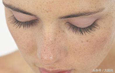 防晒霜美白祛斑的方法,防晒霜遮斑祛斑
