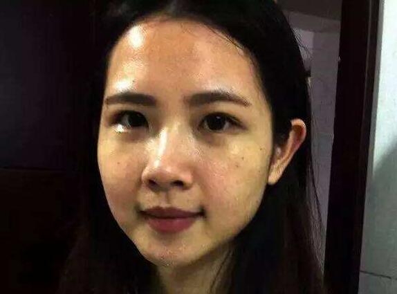 美白丸为什么吃了五天没见效果,美白丸内服全身美白真能变白吗