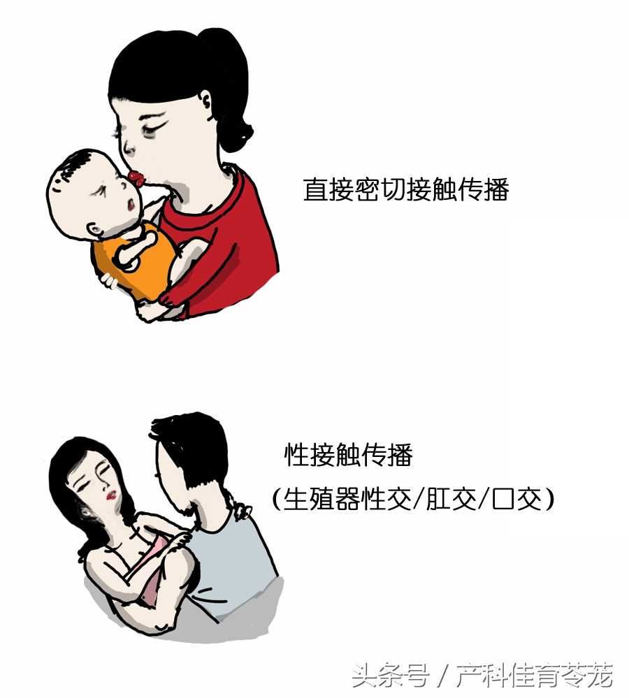 孕妈妈患有疱疹会对小孩有影响吗,孕妈妈鼻子长疱疹怎么办