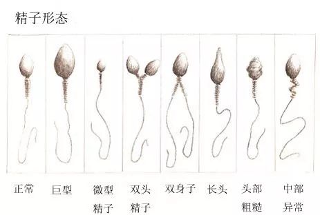 中医药辨治畸形精子症临床实践探索（附166例回顾性分析）