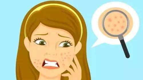 让毛孔变小用什么药,30几岁的皮肤毛孔粗能变小吗