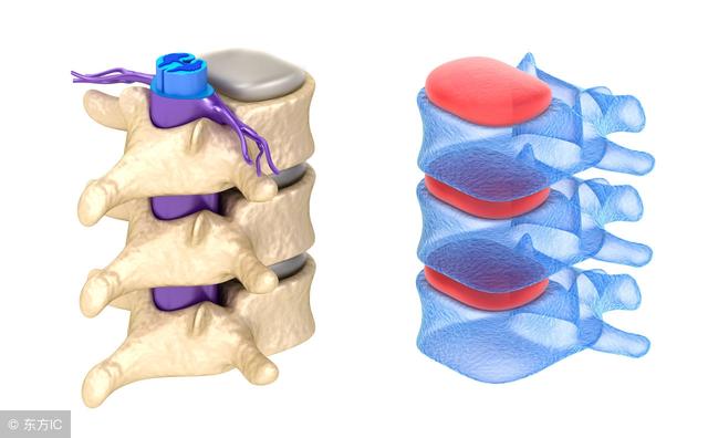 中医特效绝技治腰椎间盘痛,治腰椎间盘痛的偏方