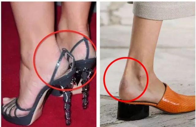 擦掉一块皮用什么药,擦掉了一小块皮一般需要多久恢复