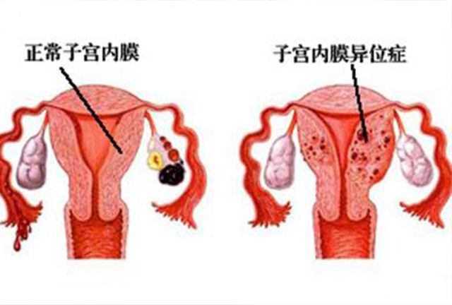 为什么有些女性怀不了孕,为什么好多女性不孕