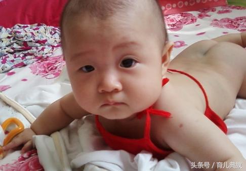一岁宝宝双眼皮突然变内双了,双眼皮一觉醒来变成单眼皮怎么办