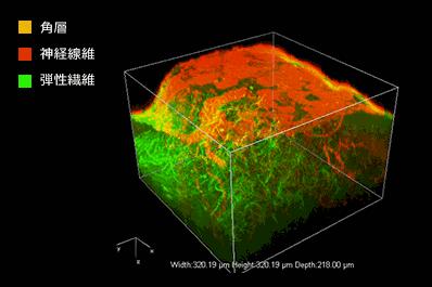 小孩身上白斑一定是白癜风吗,身上突然出现一块白癜风