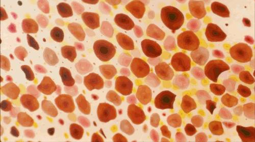 小孩身上白斑一定是白癜风吗,身上突然出现一块白癜风