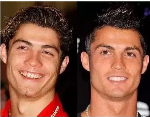 c罗整容了吗,c罗整牙颜值变化