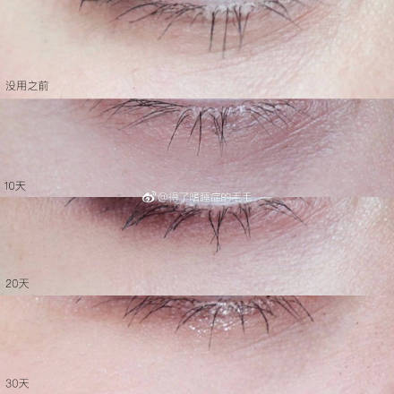 对抗眼周问题的眼霜,对抗眼袋眼霜