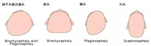 宝宝睡圆头平躺要睡多久,5个月宝宝头睡平了还能圆回来吗