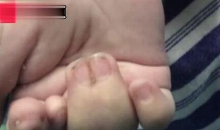 赢在起跑线上的孩子视频搞笑,萌娃发量惊人好像蒙奇奇