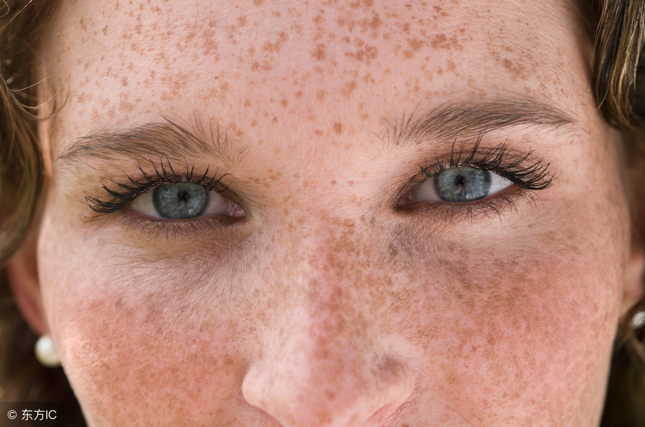 茉莉花预防褐斑最佳时间,孕期吃什么预防褐斑