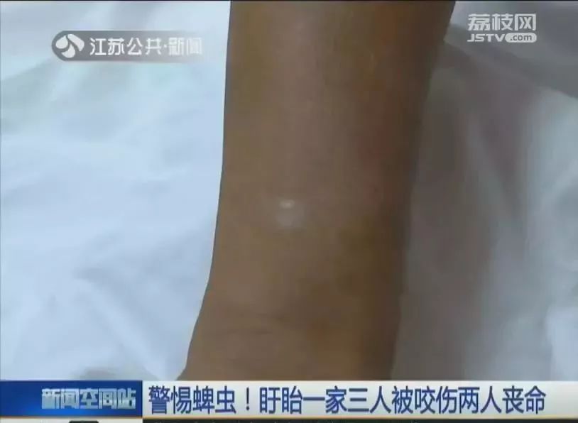 眼皮上长了个凸起小疙瘩有小黑点,2岁下眼皮忽然有个小黑点