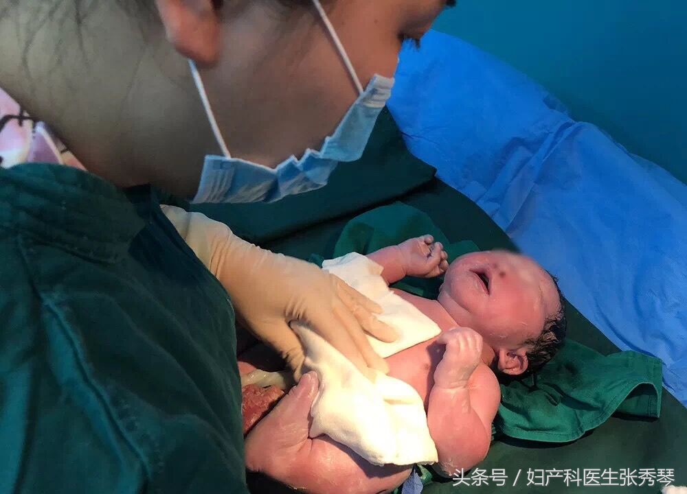 胎膜早破几小时用抗生素,40周胎膜早破多久能生