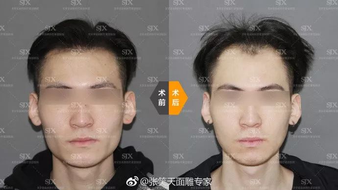 男生自己剪寸头怎么弄,男生剪寸头意味着什么