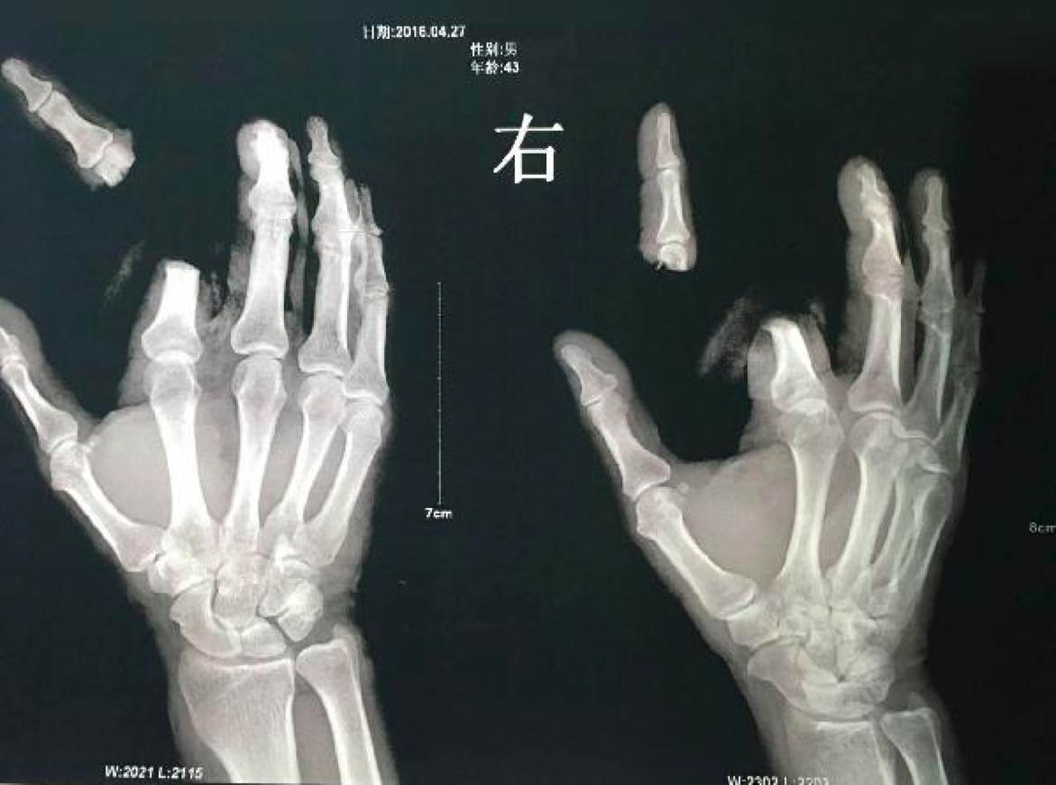 有剧毒的生物,动物界十大毒性杀手