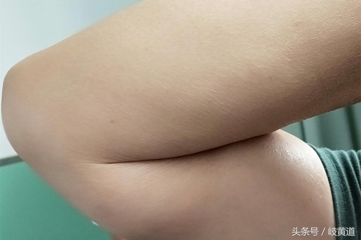 软组织感染疼痛的护理措施,皮肤及软组织感染的治疗原则