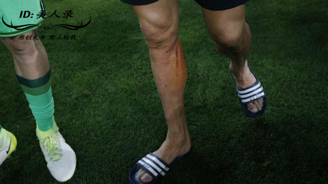 c罗受过最重的伤视频,c罗那些年欧冠