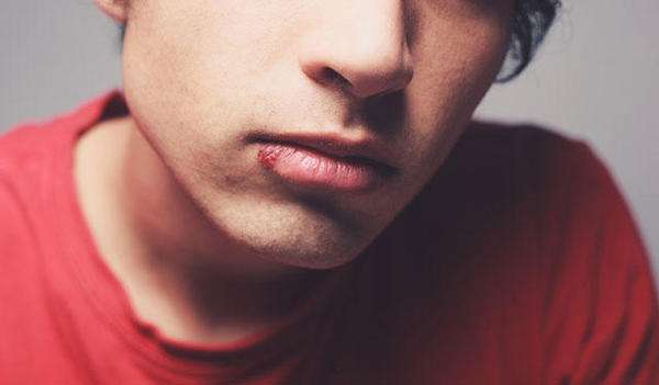 嘴上长泡了该如何解决,嘴上长泡了是什么原因