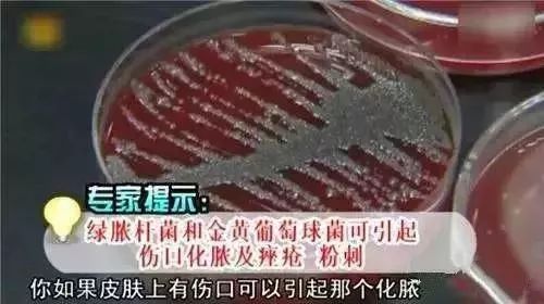 用什么洗毛巾最干净又没有螨虫,怎么去除毛巾的螨虫和细菌