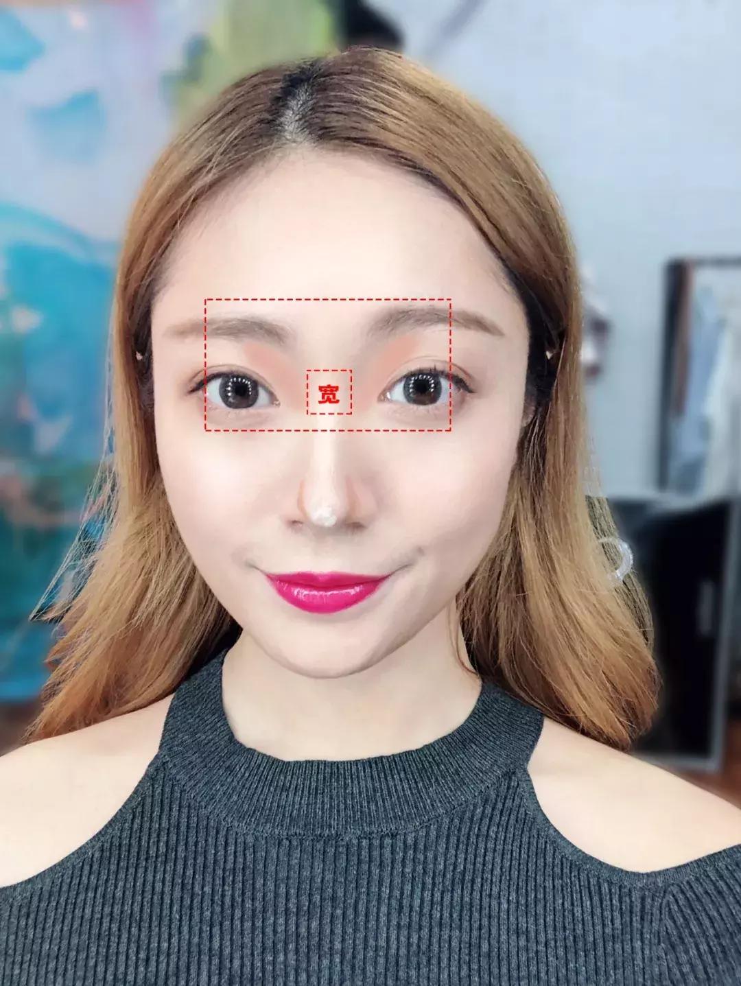 蒜头鼻怎么改变鼻型,蒜头鼻厚鼻翼怎么矫正