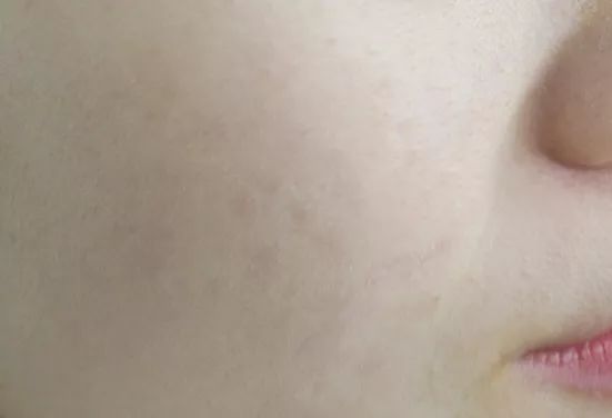 大牌粉底推荐公认好用第一名,十大遮瑕粉底液真实测评