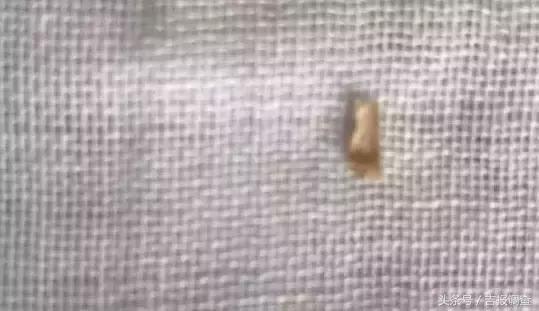 12个月小孩异物卡喉,孩子被鸡骨卡气管视频