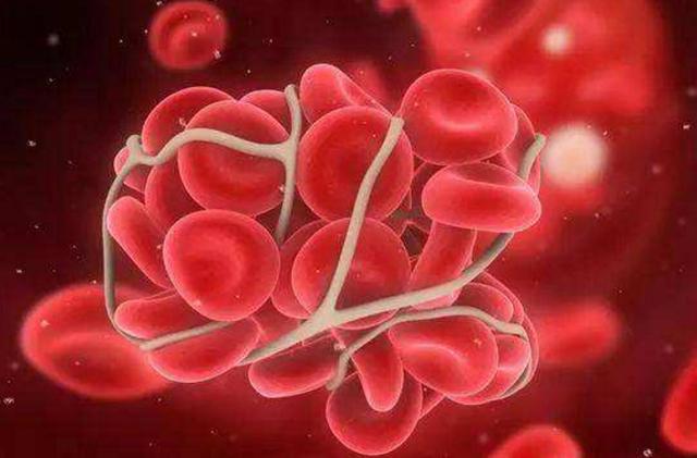 身体里的血液浓稠怎么办,如何改善血液粘稠和血管堵塞