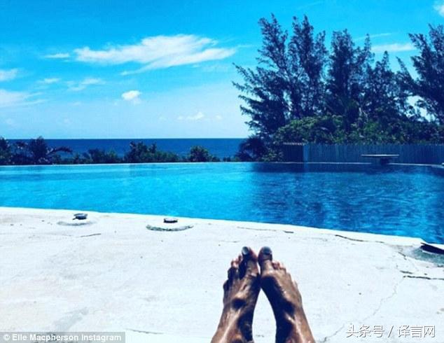 超模晒出美脚照片足部变形让人心疼：美丽背后代价重