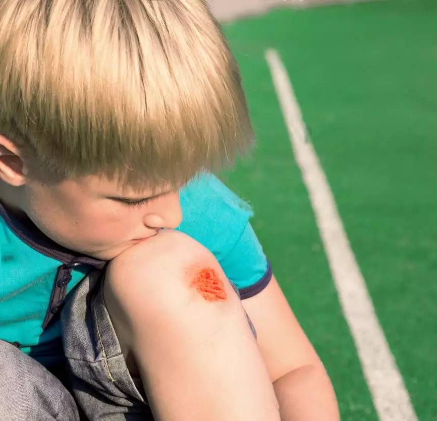 宝贝摔倒了怎么安慰,宝贝摔跤骨折怎么安慰