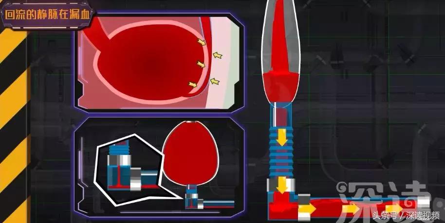 谁让你“兄弟”不给力，谁让你“痿”靡不振？阳痿诱发因素知多少