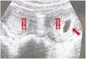 深夜产房生娃,临产孕妇在产房