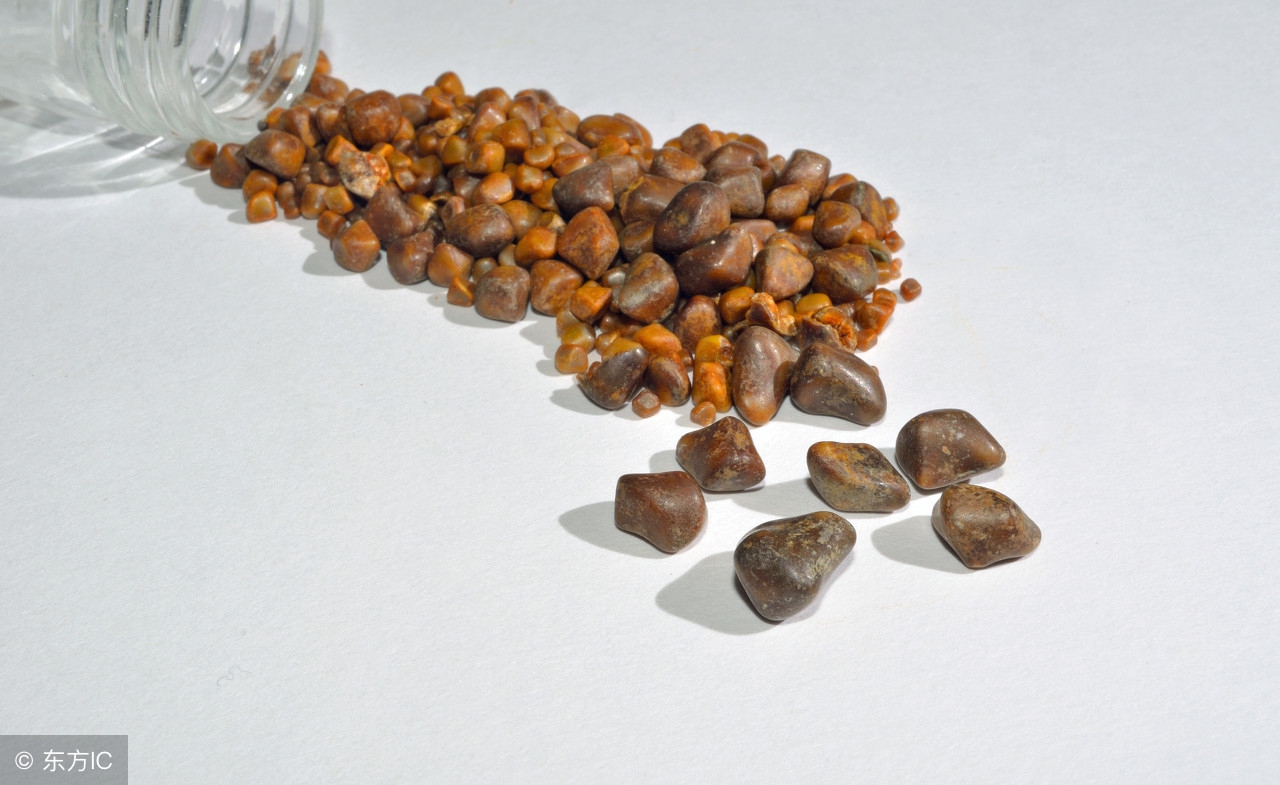 吃什么最容易引起胆囊结石,餐后胆囊结石怎么治