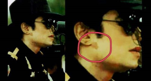 杰克逊如何把皮肤变白,关于迈克尔杰克逊怎么变白的介绍