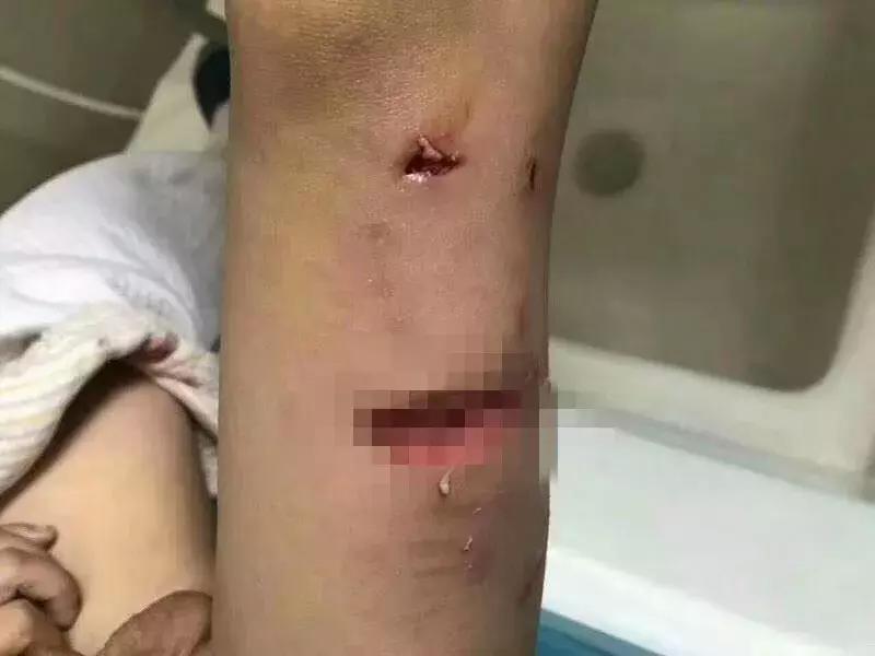 被狗紧咬怎么办,被狗咬住怎样才能挣脱