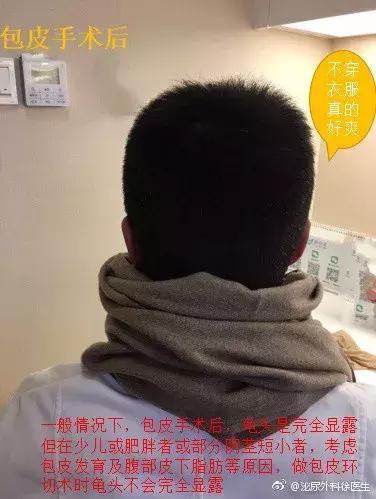 怎么判断自己的包皮需不需要割,如何判断包皮到底需不需要割