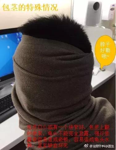 什么样的包皮一定割掉,包皮手术40几岁还能做吗